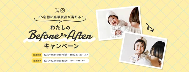 しまうまプリント わたしのBeforeAfterキャンペーン