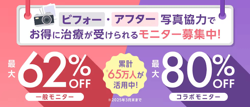 湘南美容クリニックのモニター制度